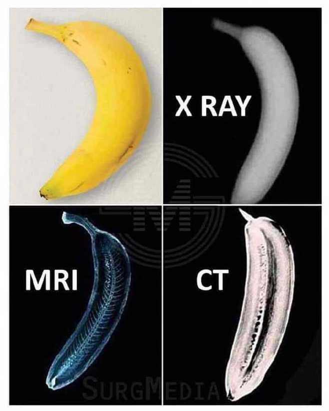 CT香蕉.jpg